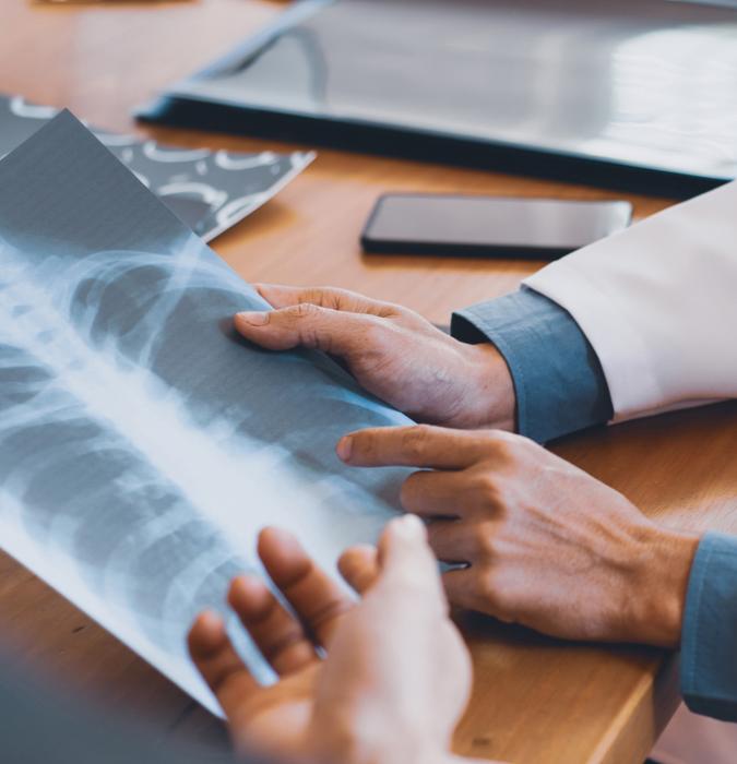 Doctor is analyzing and clarifying images of the patient's lung X-rays